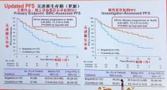 布加替尼再显神威，让ALK阳性肺癌成为慢性病